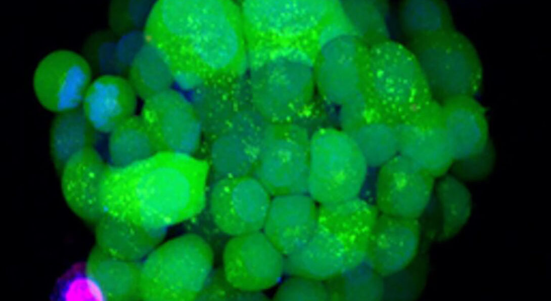 Ian Papautsky and Takeshi Shimamura A lung cancer organoid simulating a cluster of tumor cells for drug screening