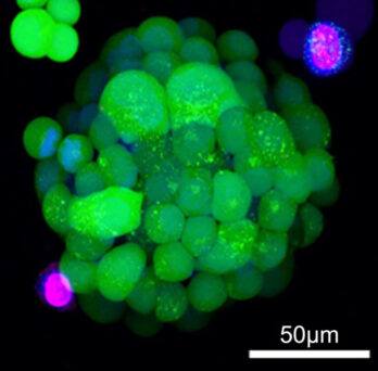 Ian Papautsky and Takeshi Shimamura A lung cancer organoid simulating a cluster of tumor cells for drug screening
                  